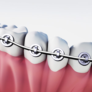 Link zu den Ringbrackets